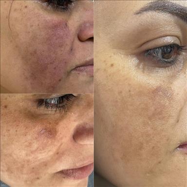 کلینیک زیبایی فیشال عادله سعادتمند  در  مشهد