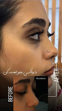کلینیک زیبایی ماه و خورشید  در  کرج