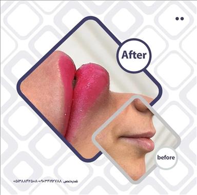 کلینیک زیبایی کلینیک زیبایی پالادیوم  در  مشهد
