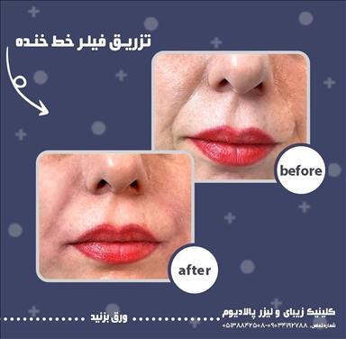 کلینیک زیبایی کلینیک زیبایی پالادیوم  در  مشهد
