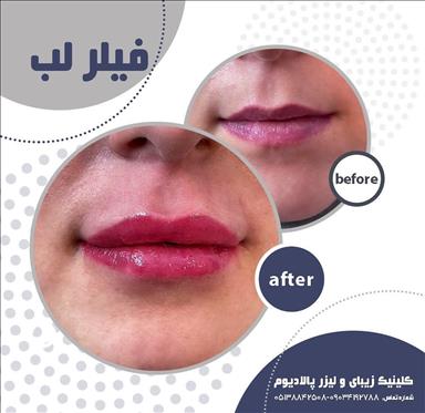 کلینیک زیبایی کلینیک زیبایی پالادیوم  در  مشهد