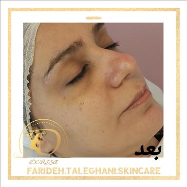 کلینیک زیبایی خدمات پوست فریده طالقانی  در  مشهد