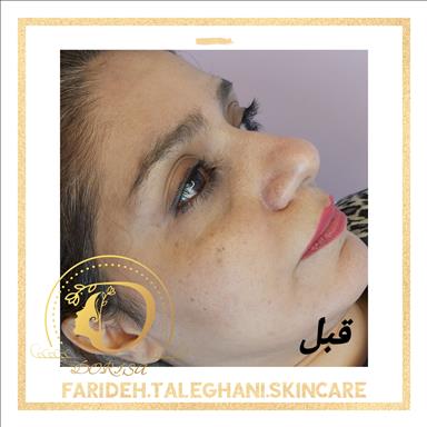 کلینیک زیبایی خدمات پوست فریده طالقانی  در  مشهد