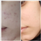 پاکسازی و فیشال فاطمه حبیبی