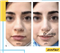 کلینیک زیبایی خدمات پوست سایه  در  مشهد
