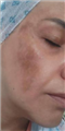 کلینیک زیبایی فیشال عادله سعادتمند مشهد کلینیک زیبایی فیشال عادله سعادتمند در مشهد